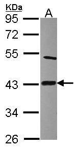 Anti-Lipoic acid synthetase antibody [N1C2] used in Western blot. GTX115528