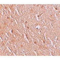 Anti-LMBRD1 antibody used in Immunohistochemistry. GTX85141