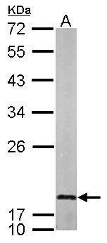 Anti-LMO1 antibody used in Western blot. GTX101726