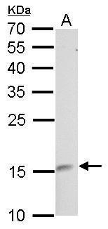 Anti-LMO1 antibody used in Western blot. GTX101726
