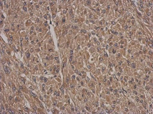 Anti-HSF2BP antibody used in IHC (Formalin-fixed paraffin-embedded sections). GTX103673