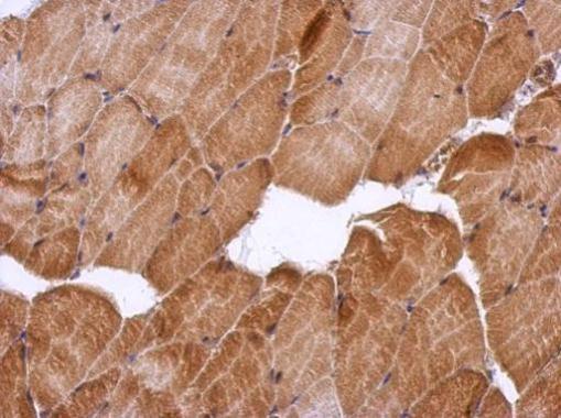 Anti-HSF2BP antibody used in IHC (Formalin-fixed paraffin-embedded sections). GTX103673