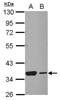 Anti-HSF2BP antibody used in Western blot. GTX103673