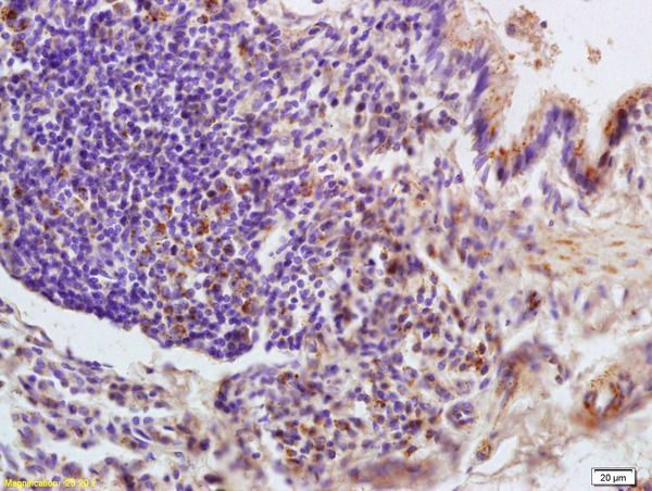 Anti-LONP1 antibody used in IHC (Formalin-fixed paraffin-embedded sections). GTX51596