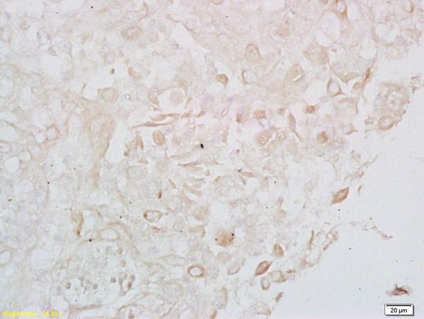 Anti-LONP1 antibody used in IHC (Formalin-fixed paraffin-embedded sections). GTX51596