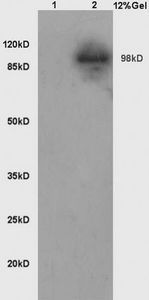 Anti-LONP1 antibody used in Western blot. GTX51596