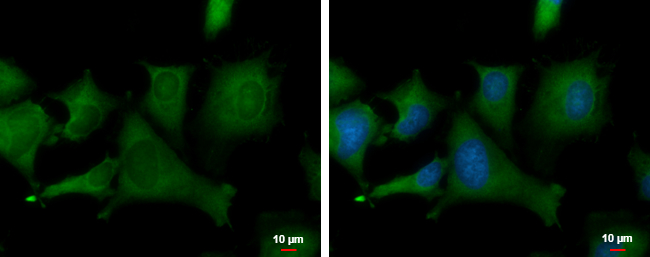 Anti-Loricrin antibody used in ICC/IF. GTX127943