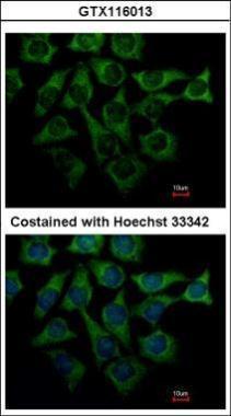 Anti-Loricrin antibody [N1], N-term used in ICC/IF. GTX116013