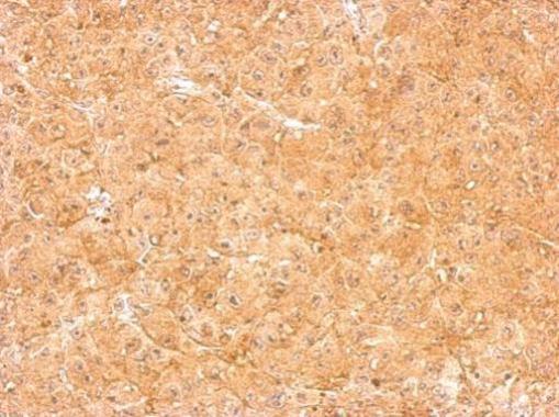 Anti-Loricrin antibody [N1], N-term used in IHC (Formalin-fixed paraffin-embedded sections). GTX116013