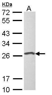 Anti-Loricrin antibody [N1], N-term used in Western blot. GTX116013