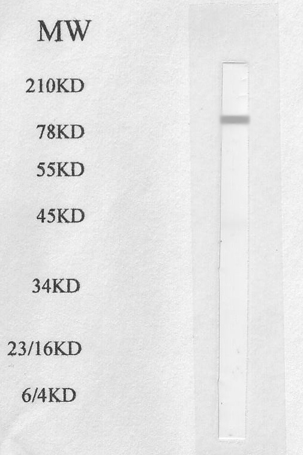 Anti-HSL/LIPE antibody used in Western blot. GTX17652