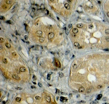 Anti-LRP5 antibody, Internal used in IHC (Formalin-fixed paraffin-embedded sections). GTX89521