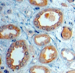 Anti-LRP6 antibody, Internal used in IHC (Formalin-fixed paraffin-embedded sections). GTX89658