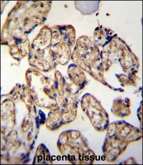 Anti-LRRC45 antibody used in IHC (Formalin-fixed paraffin-embedded sections). GTX53639
