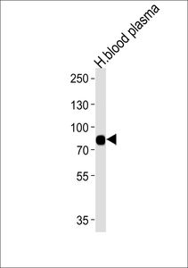 Anti-LRRC45 antibody used in Western blot. GTX53639