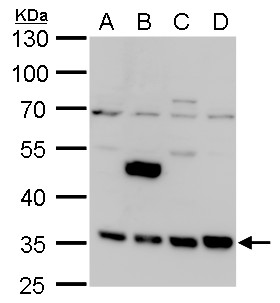 Anti-LRRC59 antibody used in Western blot. GTX123532