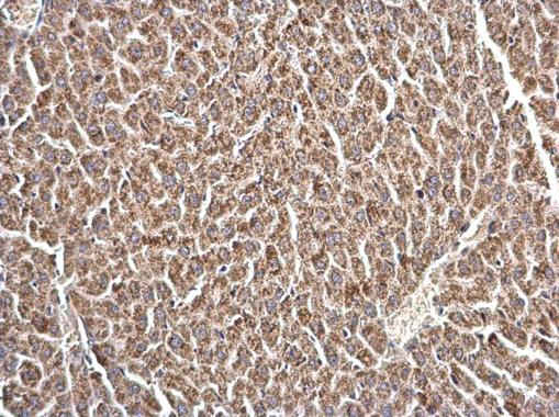 Anti-LRRC59 antibody used in IHC (Formalin-fixed paraffin-embedded sections). GTX123532