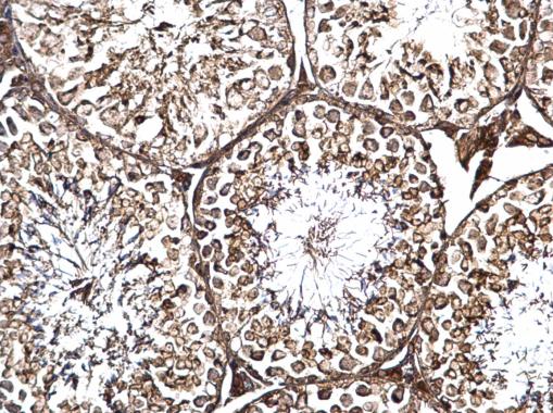 Anti-LRRC59 antibody used in IHC (Formalin-fixed paraffin-embedded sections). GTX123532