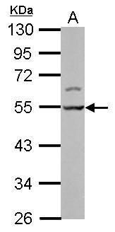 Anti-LSM11 antibody used in Western blot. GTX119023