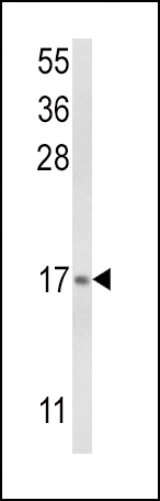 Anti-LTC4S antibody, N-term used in Western blot. GTX81159
