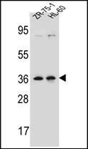 Anti-LUZP2 antibody used in Western blot. GTX53631