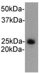 Anti-Ly-6G antibody used in Western blot. GTX37497