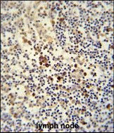 Anti-LY6G6C antibody used in IHC (Formalin-fixed paraffin-embedded sections). GTX53617