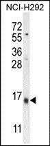 Anti-LY6G6C antibody used in Western blot. GTX53617