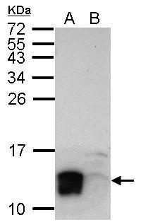 Anti-LYPD6 antibody used in Western blot. GTX123091