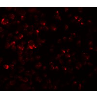 Anti-LYRM2 antibody used in ICC/IF. GTX85197