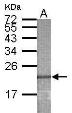 Anti-MAD4 antibody used in WB-Ag. GTX123154