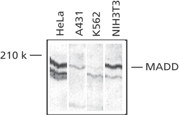 Anti-MADD antibody used in Western blot. GTX22043