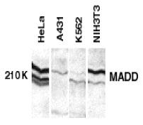 Anti-MADD antibody used in Western blot. GTX22043