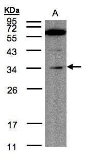 Anti-Malectin antibody used in Western blot. GTX102021