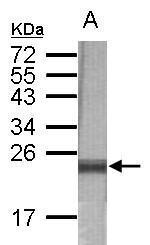Anti-MAN1A2 antibody [N2C1], Internal used in WB-Ag. GTX110067