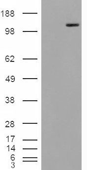 Anti-MAN2A1 antibody, Internal used in Western blot. GTX88874