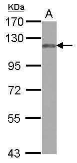 Anti-MAN2B2 antibody [C1C3] used in Western blot. GTX120906