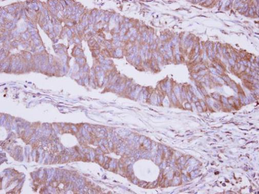 Anti-MAN2B2 antibody [N1N2], N-term used in IHC (Formalin-fixed paraffin-embedded sections). GTX120905