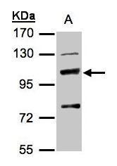 Anti-MANBA antibody [N3C2], Internal used in Western blot. GTX103124