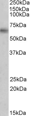Anti-MAOB antibody, Internal used in Western blot. GTX89368