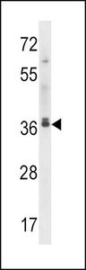 Anti-MAPRE2 antibody used in Western blot. GTX53644