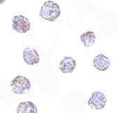 Anti-MARCH8 antibody used in ICC/IF. GTX85022