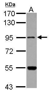 Anti-MARS2 antibody [N1N2], N-term used in Western blot. GTX118031