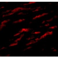 Anti-MATN1 antibody used in ICC/IF. GTX85289