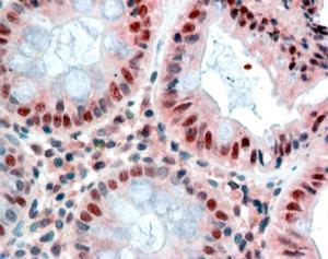 Anti-MBD2 (isoform 1) antibody, Internal used in IHC (Formalin-fixed paraffin-embedded sections). GTX89182