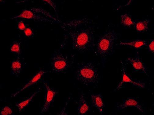 Anti-MBD2 antibody [EPR3519] used in ICC/IF. GTX62868