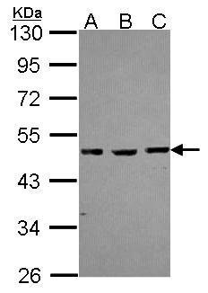 Anti-MBD2 antibody [N2C3] used in Western blot. GTX105622
