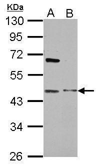 Anti-MBIP antibody used in Western blot. GTX112051