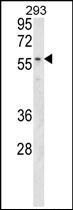 Anti-MBOAT2 antibody used in Western blot. GTX53648