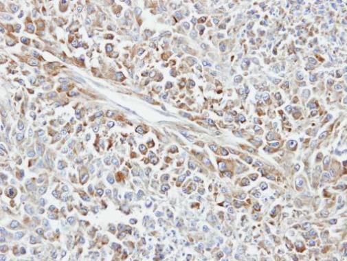 Anti-HSP70 1B antibody used in IHC (Formalin-fixed paraffin-embedded sections). GTX106148